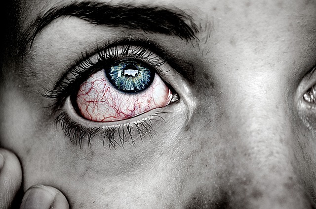What is Systemic Lupus Erythematosus (1)