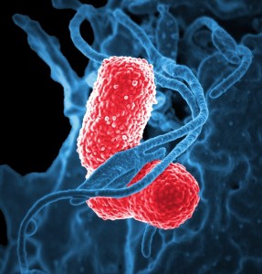 What is Systemic Lupus Erythematosus (2)