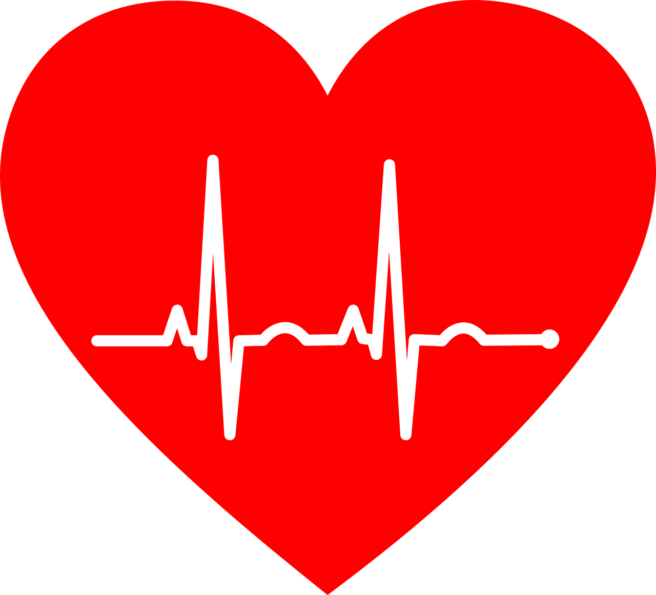 electrocardiogram